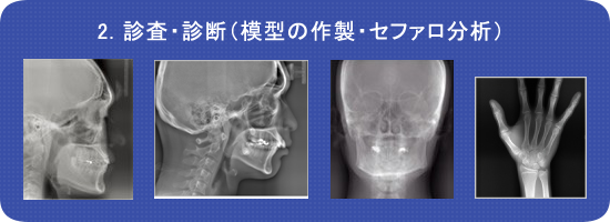 診査・診断